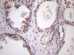 ZNF200 Antibody in Immunohistochemistry (Paraffin) (IHC (P))