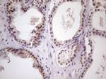 ZNF200 Antibody in Immunohistochemistry (Paraffin) (IHC (P))