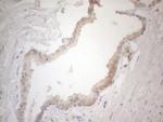 ZNF200 Antibody in Immunohistochemistry (Paraffin) (IHC (P))