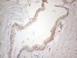 ZNF200 Antibody in Immunohistochemistry (Paraffin) (IHC (P))
