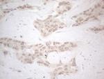 ZNF200 Antibody in Immunohistochemistry (Paraffin) (IHC (P))