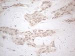 ZNF200 Antibody in Immunohistochemistry (Paraffin) (IHC (P))
