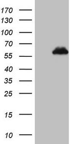 ZNF200 Antibody in Western Blot (WB)