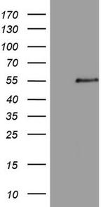 ZNF200 Antibody in Western Blot (WB)