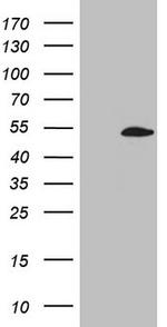 ZNF200 Antibody in Western Blot (WB)