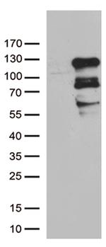 ZNF202 Antibody in Western Blot (WB)