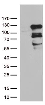ZNF202 Antibody in Western Blot (WB)