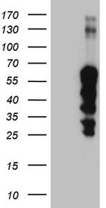 ZNF213 Antibody in Western Blot (WB)