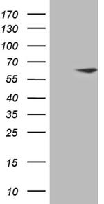 ZNF213 Antibody in Western Blot (WB)