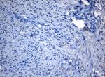 ZNF217 Antibody in Immunohistochemistry (Paraffin) (IHC (P))