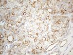 ZNF217 Antibody in Immunohistochemistry (Paraffin) (IHC (P))
