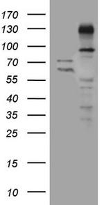 ZNF217 Antibody in Western Blot (WB)