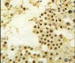 ZNF219 Antibody in Immunohistochemistry (IHC)