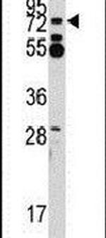 ZNF219 Antibody in Western Blot (WB)