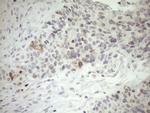 ZNF230 Antibody in Immunohistochemistry (Paraffin) (IHC (P))