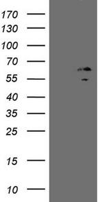 ZNF230 Antibody in Western Blot (WB)