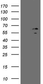 ZNF230 Antibody in Western Blot (WB)