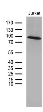 ZNF264 Antibody in Western Blot (WB)
