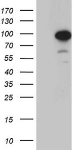 ZNF264 Antibody in Western Blot (WB)