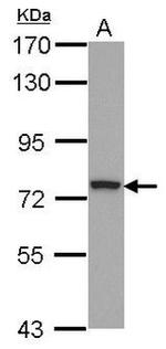 ZNF266 Antibody in Western Blot (WB)