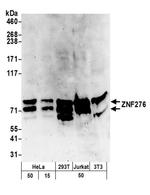 ZNF276 Antibody in Western Blot (WB)