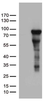 ZNF317 Antibody in Western Blot (WB)