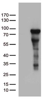 ZNF317 Antibody in Western Blot (WB)