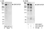 ZNF318/TZF Antibody in Western Blot (WB)