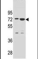 ZNF324B Antibody in Western Blot (WB)