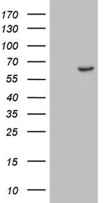 ZNF329 Antibody in Western Blot (WB)
