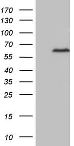 ZNF329 Antibody in Western Blot (WB)