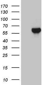 ZNF329 Antibody in Western Blot (WB)