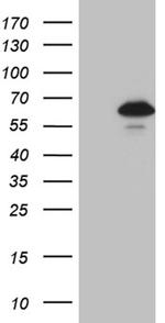 ZNF329 Antibody in Western Blot (WB)
