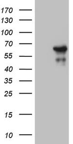 ZNF329 Antibody in Western Blot (WB)