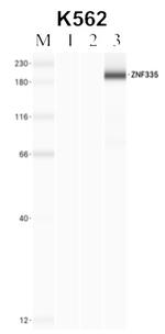 ZNF335 Antibody in Immunoprecipitation (IP)