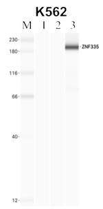 ZNF335 Antibody in Immunoprecipitation (IP)