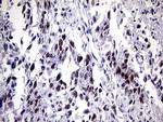 ZNF34 Antibody in Immunohistochemistry (Paraffin) (IHC (P))