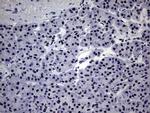 ZNF34 Antibody in Immunohistochemistry (Paraffin) (IHC (P))