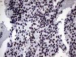 ZNF34 Antibody in Immunohistochemistry (Paraffin) (IHC (P))