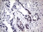 ZNF34 Antibody in Immunohistochemistry (Paraffin) (IHC (P))