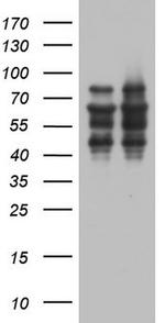 ZNF34 Antibody in Western Blot (WB)