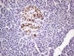 ZNF35 Antibody in Immunohistochemistry (Paraffin) (IHC (P))