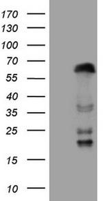 ZNF35 Antibody in Western Blot (WB)