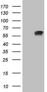ZNF35 Antibody in Western Blot (WB)