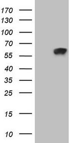 ZNF35 Antibody in Western Blot (WB)