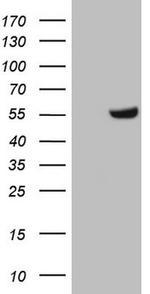 ZNF35 Antibody in Western Blot (WB)