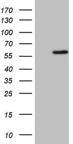 ZNF35 Antibody in Western Blot (WB)