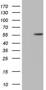 ZNF35 Antibody in Western Blot (WB)