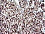 ZNF365 Antibody in Immunohistochemistry (Paraffin) (IHC (P))