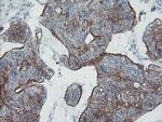 ZNF365 Antibody in Immunohistochemistry (Paraffin) (IHC (P))